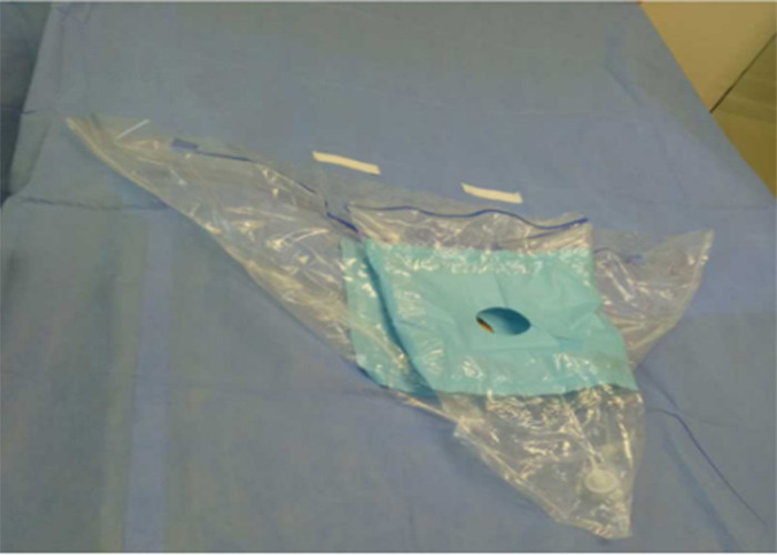  Knee Arthroscopy Fluid Collection Bag Disposable Sterile Surgical Drape Support Manufactures