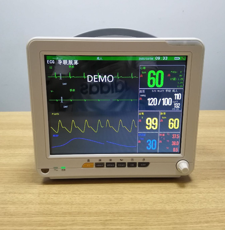  Portable ECG Medical Device for Home All In One Detector Off-White ABS Material Manufactures