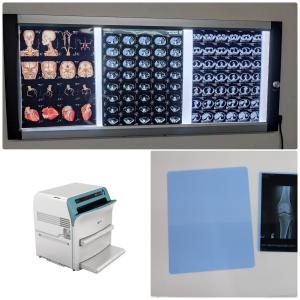 China ISO9001 Ct Scan X Ray Film 14x17 Inch Medical Digital X Ray Film on sale