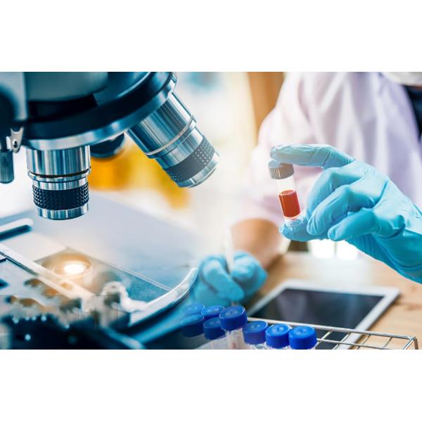 IgG IgM Coronavirus Test Kit