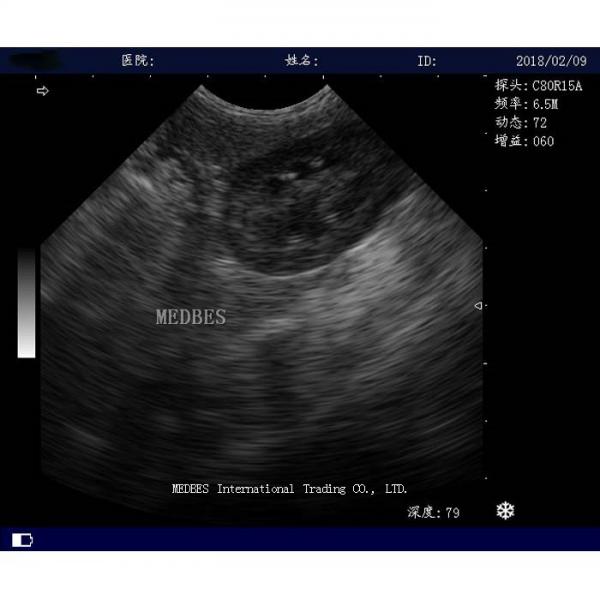 Hospital Digital Trolley color doppler ultrasound Transvaginal Ultrasound
