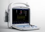 18.5 Inch Touch Monitor Ultrasound Scanner Colour Doppler Test With Convex Probe