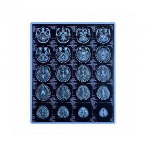  CE Printable Blue Medical X Ray Film 11x14 Inch Pet Inkjet Film Manufactures