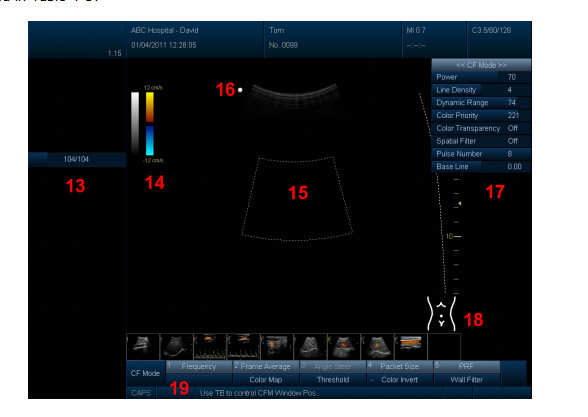 4D Color Doppler Ultrasound Scanner with 3.5MHz / R40 Volume Probe