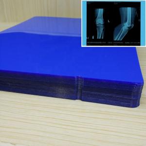 China ISO9001 Blue Inkjet Film Medical Inkjet Printing Film 11*14In on sale