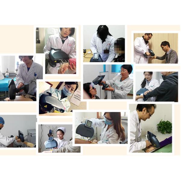 High Dose 308NM Excimer System Xecl Laser 18s Erythema Home Use