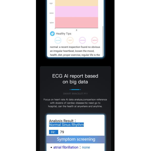 Detecting PPG ECG Temperature Bracelet IP67 Smart Bracelet Heart Rate Blood Pressure