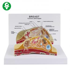 Female Cross Section Breast Cancer Model Anatomical 1.0 Kg Single Gross Weight Manufactures