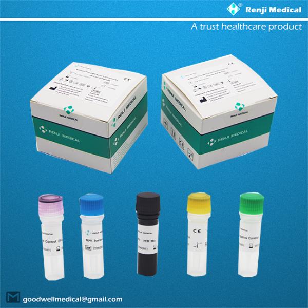 Monkeypox Virus MPV Nucleic Acid Detection Kit Real Time PCR Method