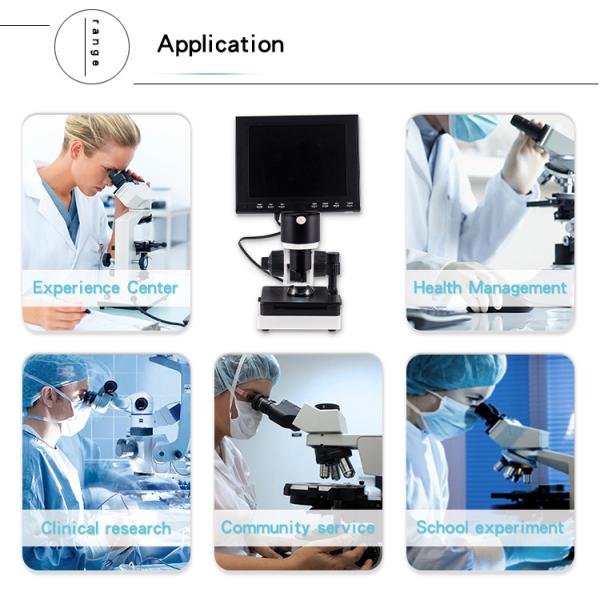 LCD Digital Biological Microscope Microcirculation Checking Capillary Microscope