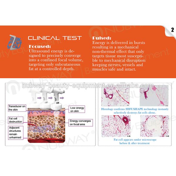 HIFU Body Fat Slimming! Newest Ultrashape Machine High Intensity Focused Ultrasound HIFU