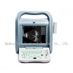 China Best Quality Ophthalmic Equipment Ophthalmic Ab Scan ODU8