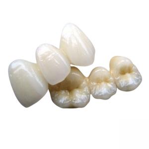  PFM Co Cr 3014652903 Ceramic Dental Bridge Custom Colour Stability Manufactures