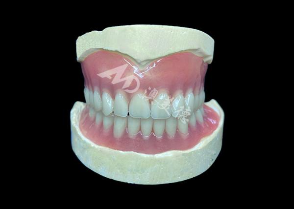 Easy-to-Clean Custom Cast Partial Dentures Ideal for Restoring Chewing Ability