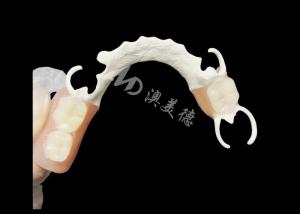 China Custom Cast Partial Denture with HPP framework for Enhanced Chewing and Speech on sale