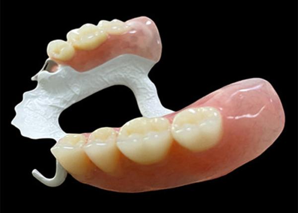 Quality Customized Partial Removable Denture with High-Performance Polymer (HPP) Framework for Superior Comfort and Durability for sale