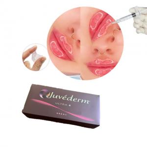  Juvederm Ultra3 Hyaluronic Acid Dermal Filler Lip Enhancement Manufactures