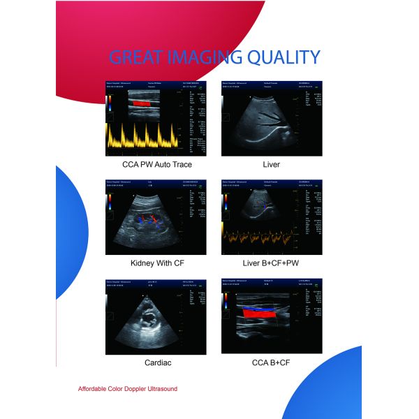 CONTEC CMS1700B Color Doppler Professional Diagnostic cardiology Ultrasonic Diagnostic System echocardiography machine p